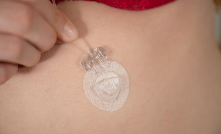 O que é e para que serve a insulinização