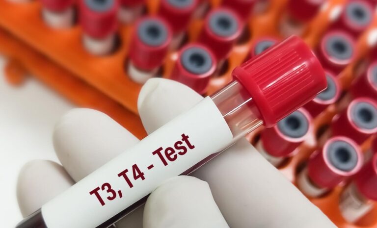 Hormônios da tireoide: quais são, para que servem e quais os níveis ideais